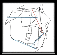 TMJ diagram